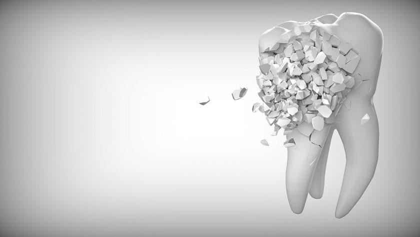 Agram dental wanneer spoed tandarts