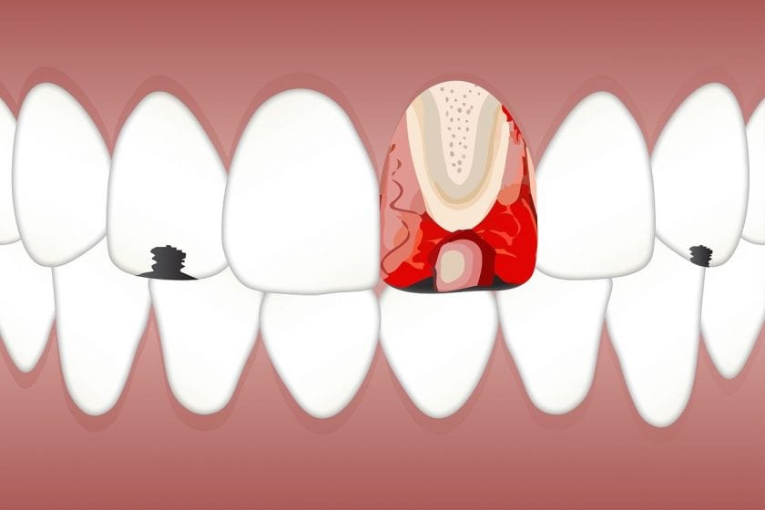 Dentoffice tandarts lachgas