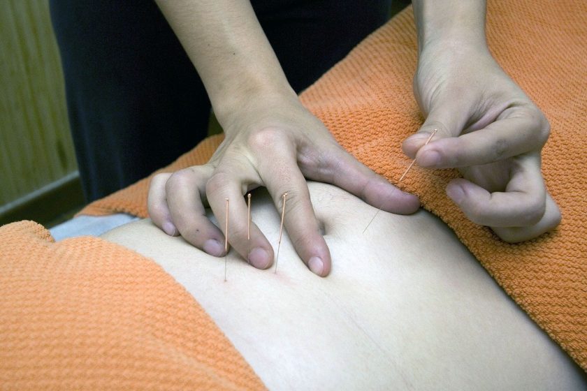 Fysiotherapie I. Riekwel-Verstraete dry needling