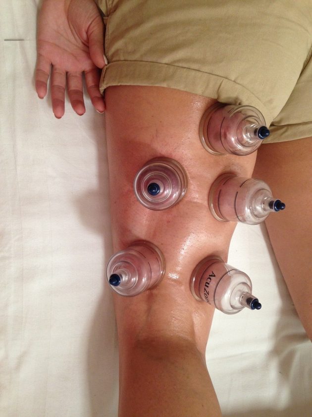 Spiegel Massages De massage fysio