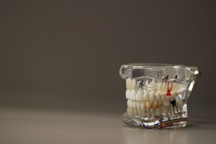 Tandartsen & Specialisten Ivory & Ivory Utrecht tandarts onder narcose