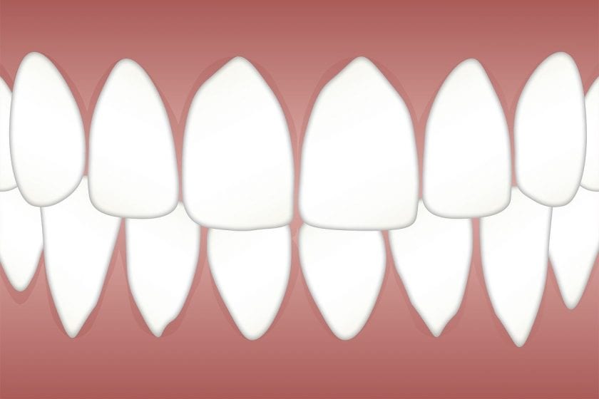 Tandheelkunde & Implantologie Centrum voor tandarts