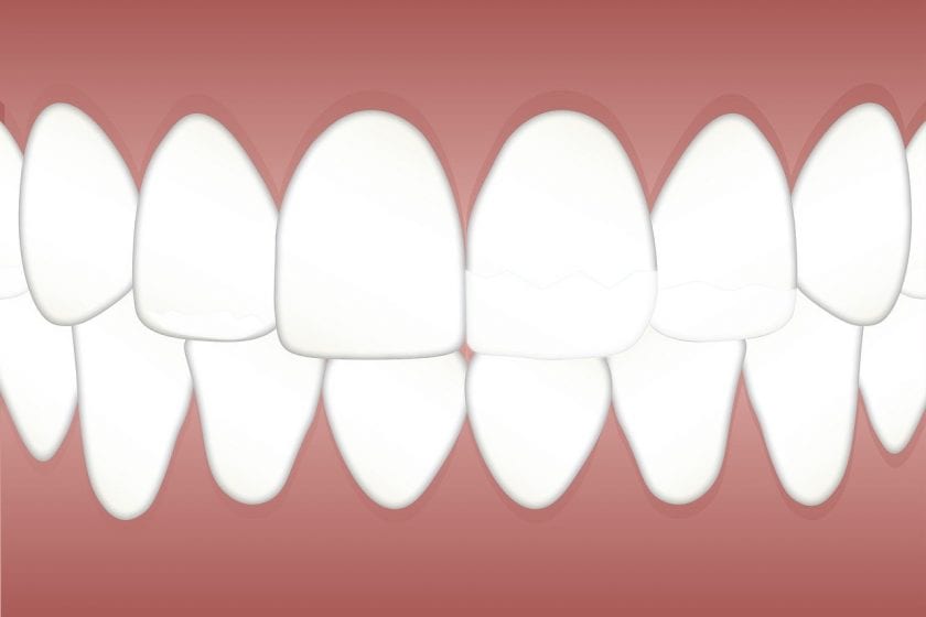 A. Vermeulen Tandarts tandarts behandelstoel
