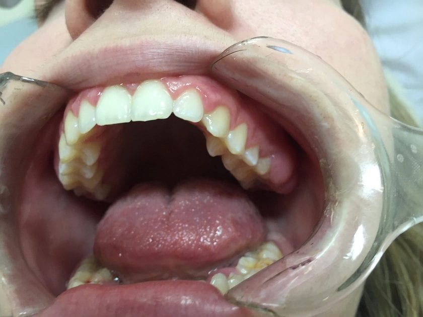 Baronie Tandartenspraktijk De angst tandarts