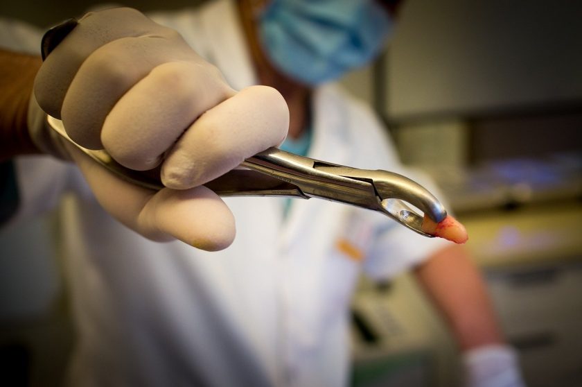 Tandarts praktijk Herpen spoedhulp door narcosetandarts en tandartsen