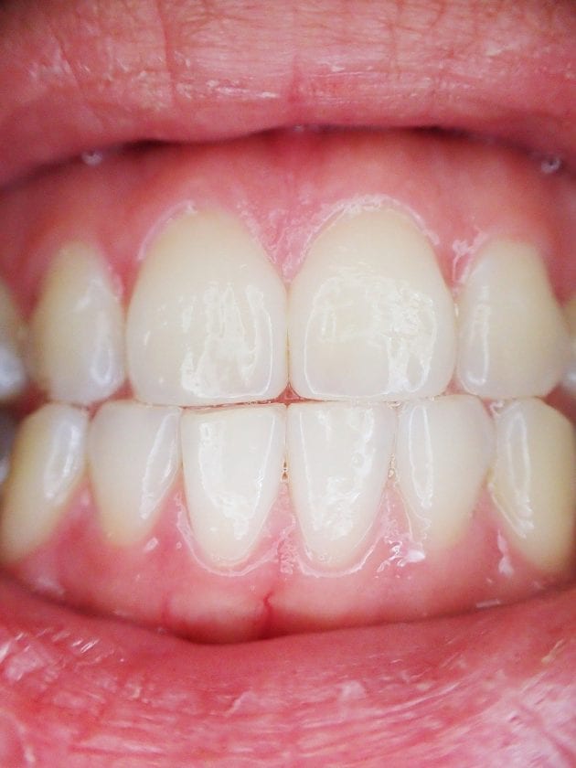 Tandarts praktijk Klimmen spoedhulp door narcosetandarts en tandartsen