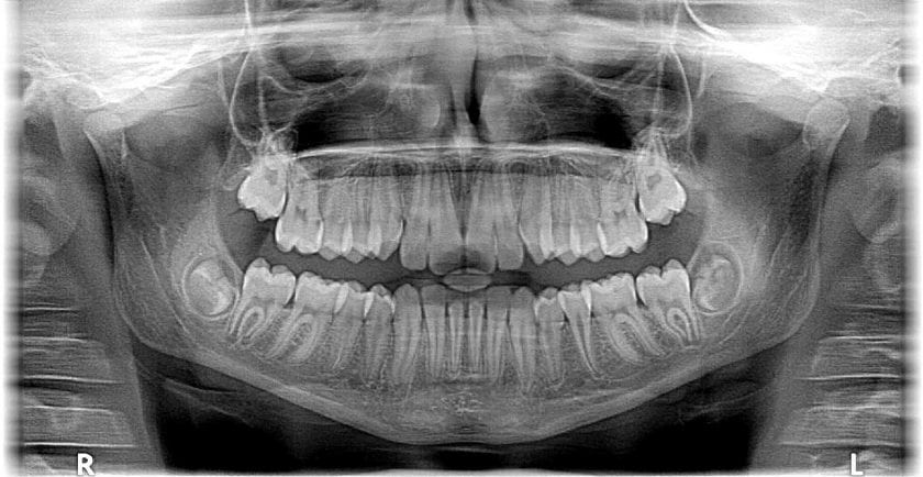 Tandarts praktijk Sprengenbos spoedhulp door narcosetandarts en tandartsen