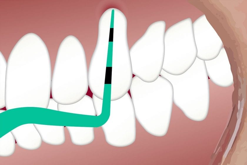 C.D.G. Tandheelkunde tandarts lachgas
