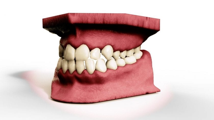 Dental Clinics Almelo bang voor tandarts