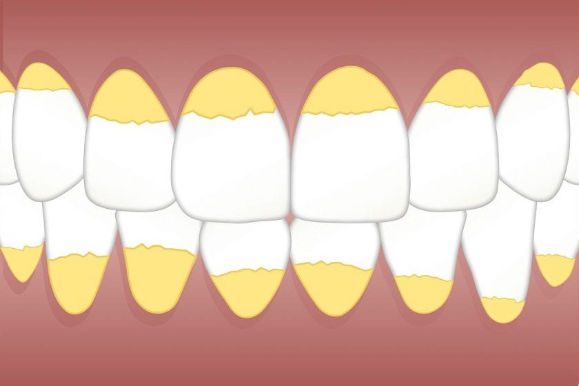 Dental Clinics Bergschenhoek spoedeisende tandarts