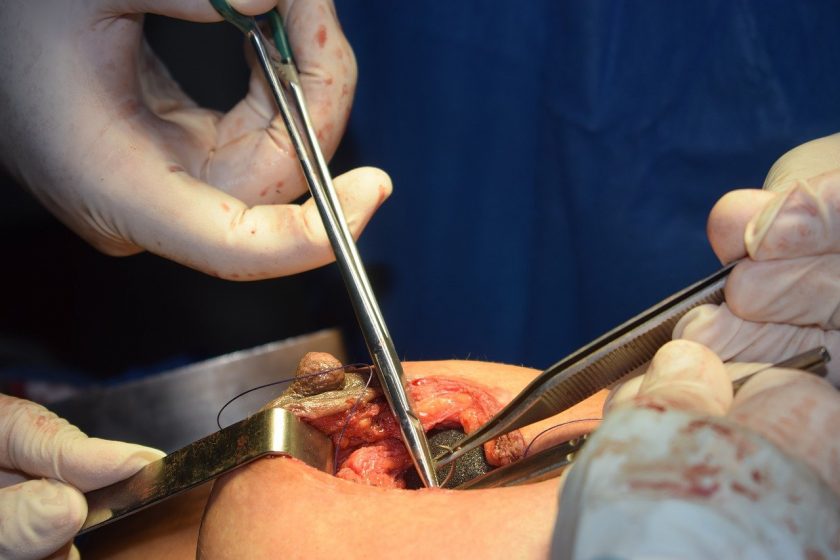Entercare BV poli kliniek plastische chirurgie ervaringen