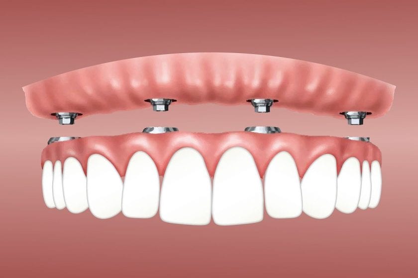 Grinberg Tandartspraktijk spoedeisende tandarts