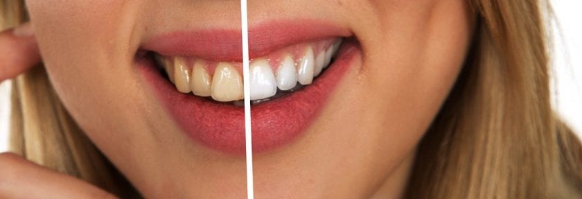 Kliniek voor Tandheelkunde De narcose tandarts kosten