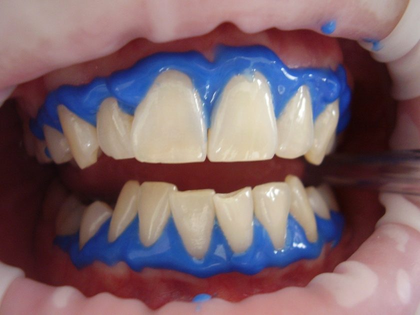 SHM Dental Care tandarts weekend
