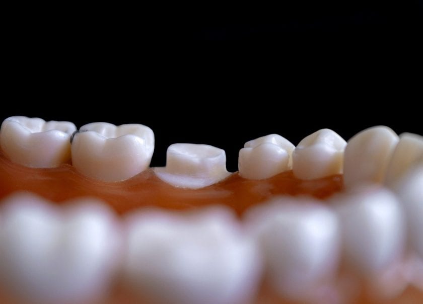 SME Menke, tandarts bang voor tandarts