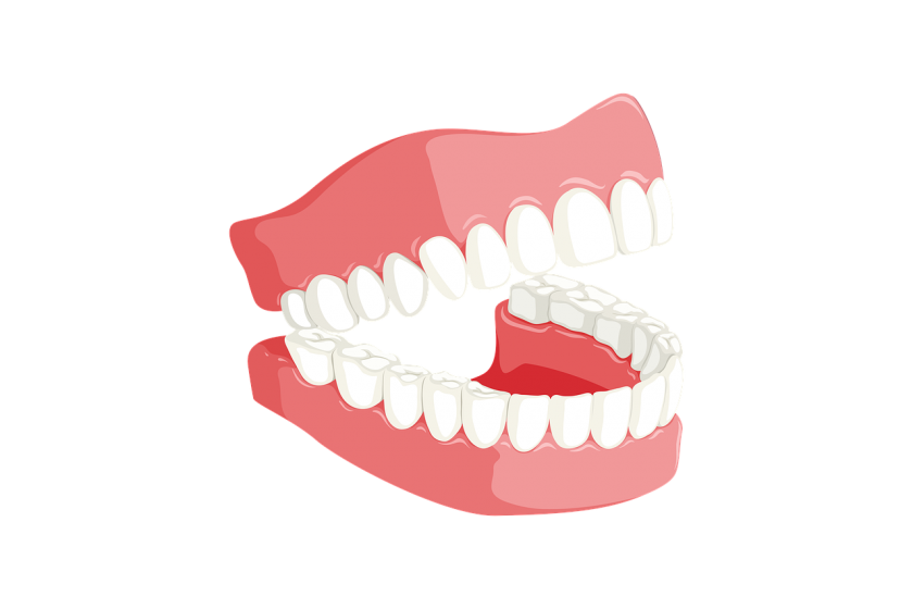 Smile Clinic IJsselmonde tandarts spoed