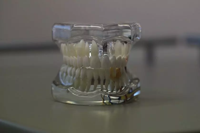 Tandartsenpraktijk Swaters & Kremer tandarts lachgas