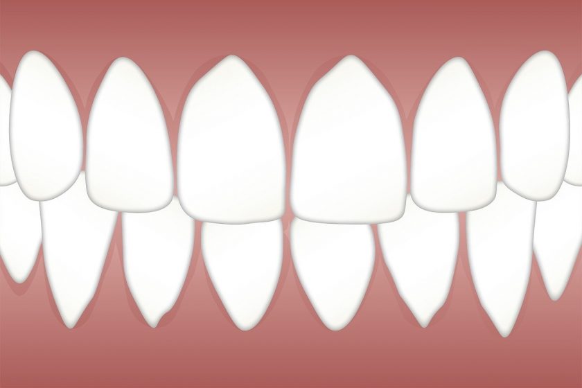 Tandartspraktijk De Singel spoedhulp tandarts