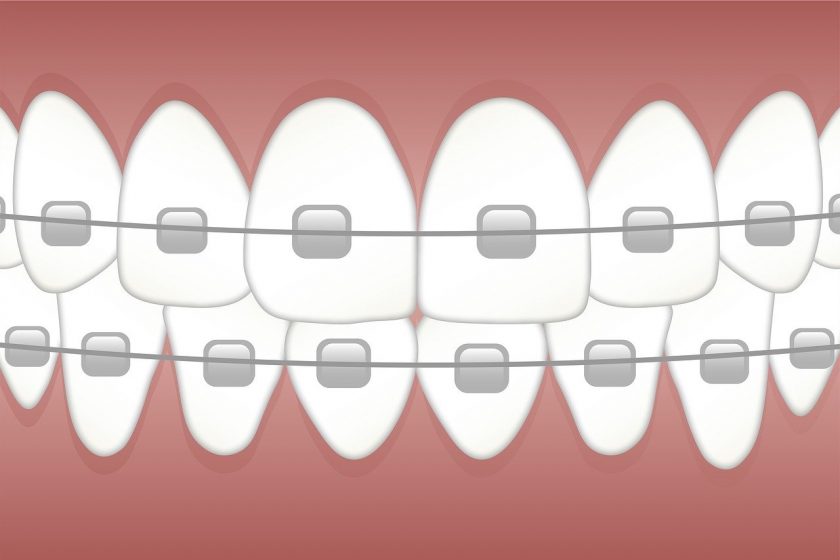 Tandartspraktijk F. Nugteren wanneer spoed tandarts