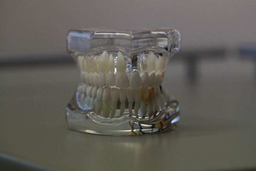Tandartspraktijk Nibbixwoud BV angst tandarts