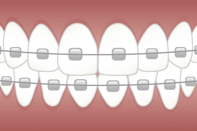 Tandartspraktijk R P van Rens wanneer spoed tandarts