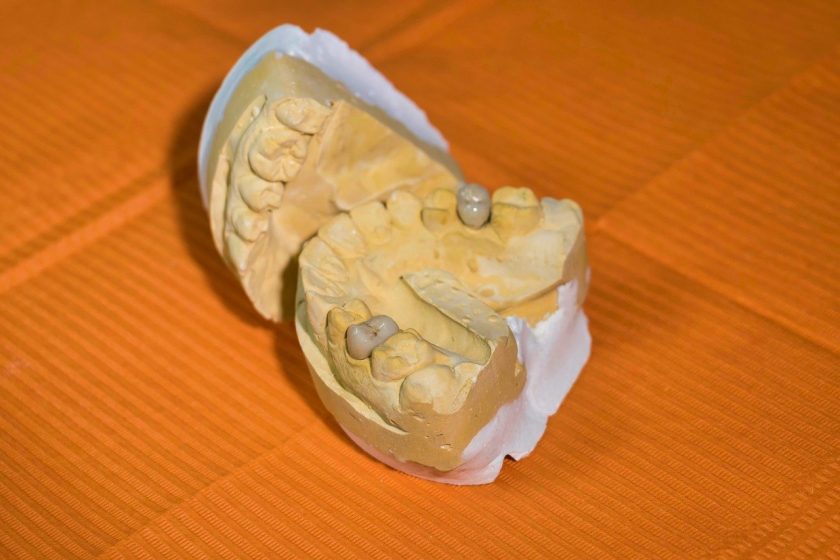 Tandarts praktijk Poortvliet spoedhulp door narcosetandarts en tandartsen