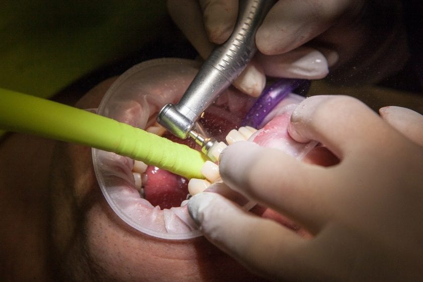 Tandarts praktijk Waarde spoedhulp door narcosetandarts en tandartsen