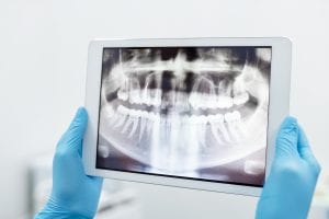 angst- en narcose tandarts in Norg