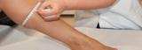 Huid- en Oedeemcentrum huidverbetering en laserontharing