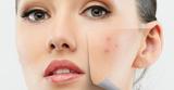 Medical Beauty Center huidverbetering en laserontharing