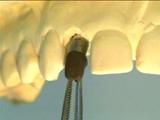 Hover Tandartspraktijk angst tandarts