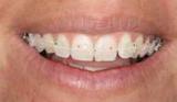 Tandartspraktijk en Mondhygiënist Praktijk Azar angst tandarts