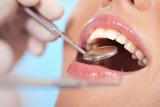 Tandheelkunde Goudsesingel angst tandarts