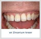 Kliniek voor Cosmetische Tandheelkunde Amsterdam Zuid beste narcose tandarts kosten