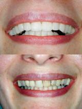 Tandheelkunde Goudsesingel beste narcose tandarts kosten