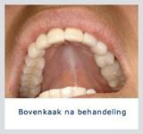Kliniek voor Cosmetische Tandheelkunde Amsterdam Zuid beste spoed tandarts