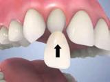 Tandheelkunde Goudsesingel beste spoed tandarts