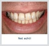 Kliniek voor Cosmetische Tandheelkunde Amsterdam Zuid beste tandartspraktijk
