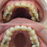 Tandheelkunde Goudsesingel beste tandartspraktijk