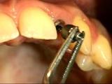 Hover Tandartspraktijk narcose tandarts