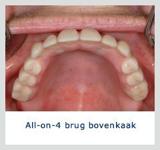 Kliniek voor Cosmetische Tandheelkunde Amsterdam Zuid narcose tandarts