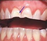 Tandheelkunde Goudsesingel narcose tandarts
