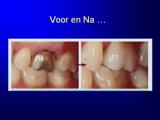 Donker Borghouts Tandartsenpraktijk spoed tandarts