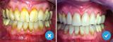 Strang Tandartspraktijk spoed tandarts