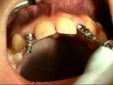 Hover Tandartspraktijk spoedeisende tandarts