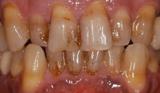 Tandartsenpraktijk W H Polet spoedeisende tandarts