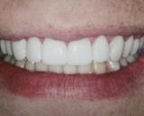 Tandartspraktijk Ringers spoedeisende tandarts