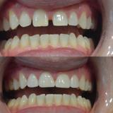Tandheelkunde Goudsesingel spoedeisende tandarts