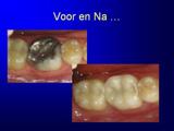 Donker Borghouts Tandartsenpraktijk spoedhulp tandarts