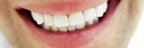 Tandartsencentrum Landsmeer spoedhulp tandarts